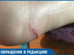 Возвращаясь вечером домой по Пламя Революции, чуть не сломала ногу, - морозовчанка 