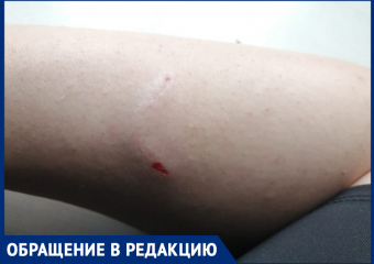 Женщину искусала стая бездомных собак в центре Морозовска