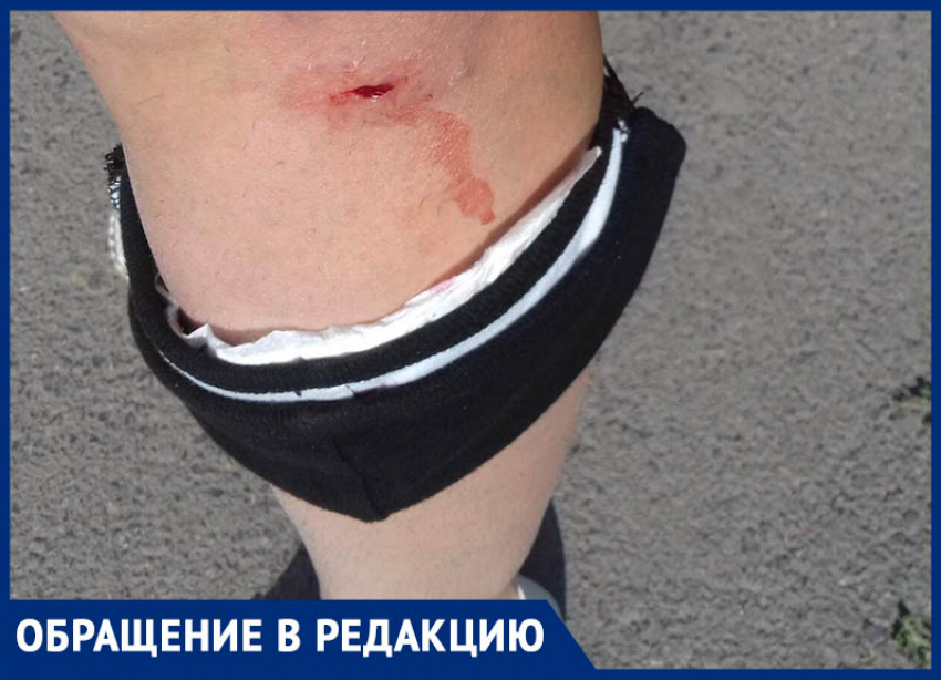 Собака укусила морозовчанку прямо на рынке